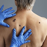 DermVA - Surgical Dermatology Circle